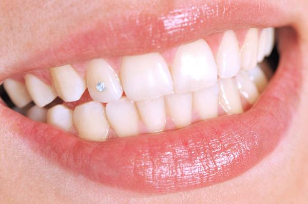 GBDental - fogékszer.