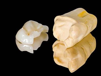 öntött tömés